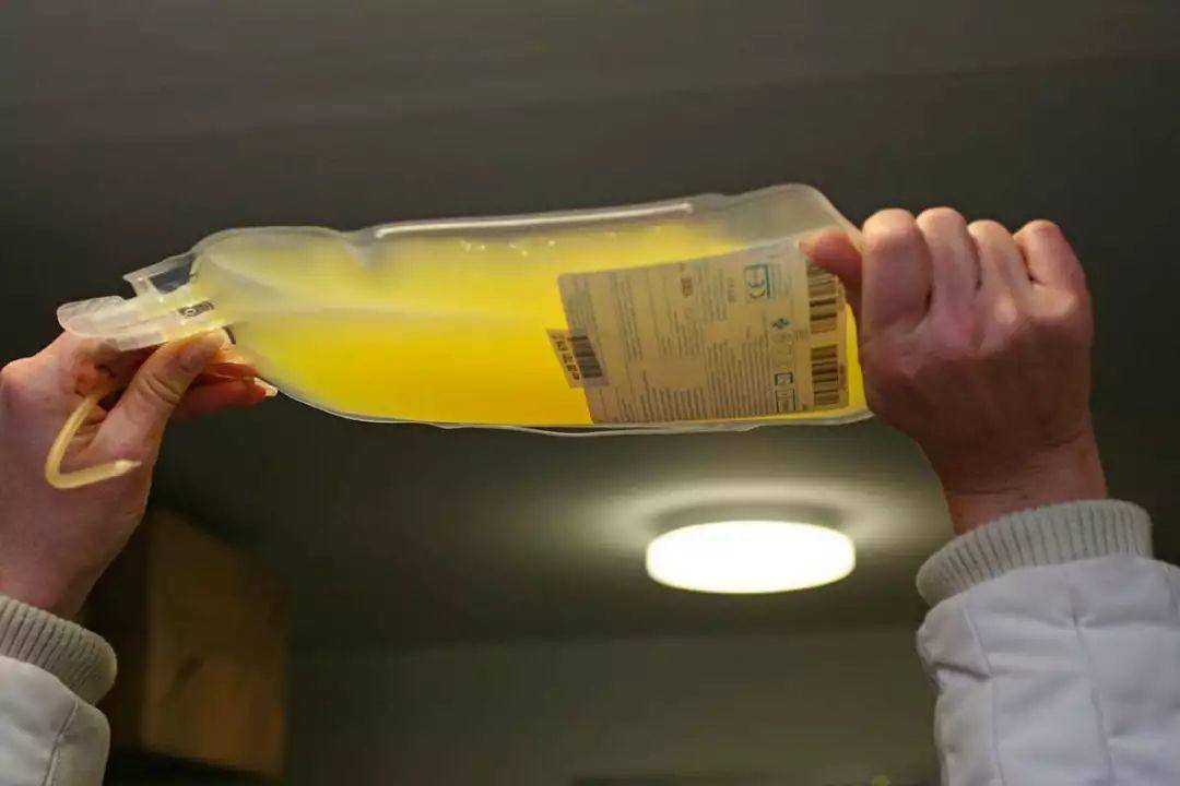 用年輕人的血液來治療帕金森？一家公司正在對這種治療方法進行試驗-肽度TIMEDOO