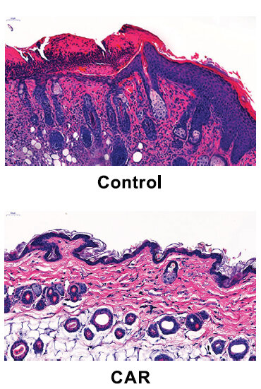 201903080854106418.jpg 新進(jìn)展!Science子刊:CAR-T療法治療小鼠狼瘡顯威力-肽度TIMEDOO