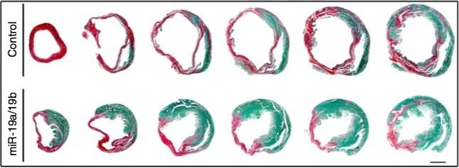 microRNAs當(dāng)?shù)?一劑注射長效保護(hù)受損心臟！-肽度TIMEDOO