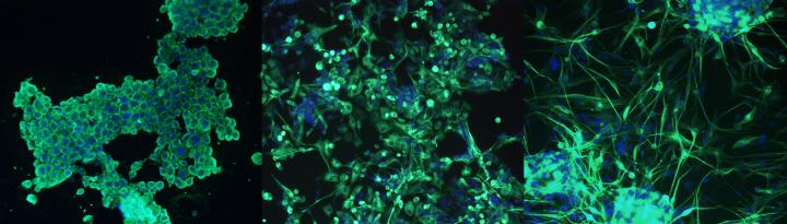 科學(xué)家感嘆，癌細(xì)胞簡直是為適應(yīng)環(huán)境而生的藝術(shù)家-肽度TIMEDOO