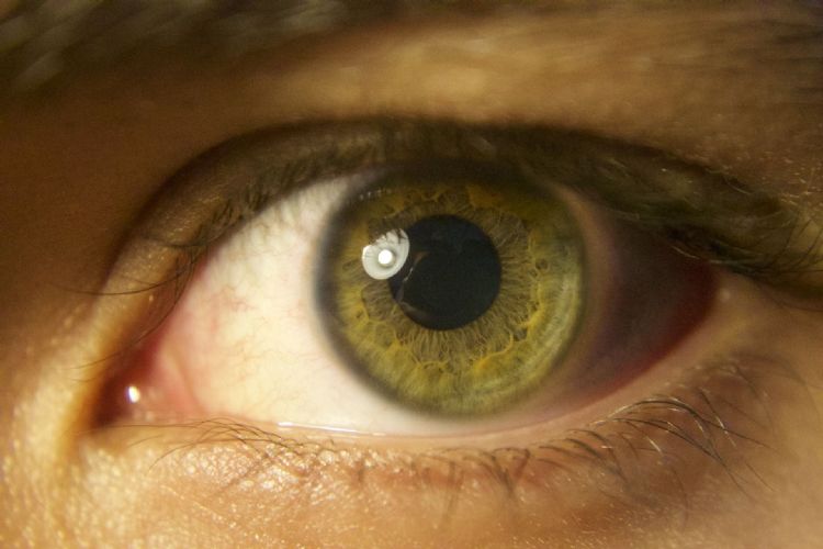 Google運用人工智能協(xié)助印度糖尿病患者預防視網(wǎng)膜病變-肽度TIMEDOO