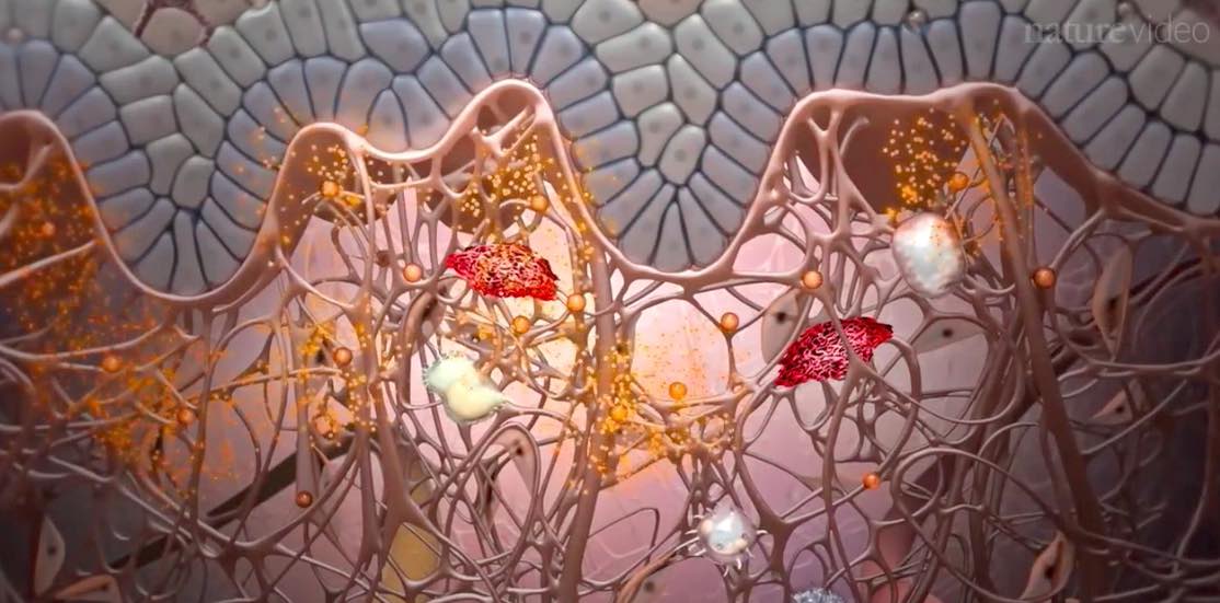 醫(yī)學(xué)動(dòng)畫:微觀世界大片觀看免疫系統(tǒng)如何出錯(cuò),形成銀屑病的全過(guò)程-肽度TIMEDOO