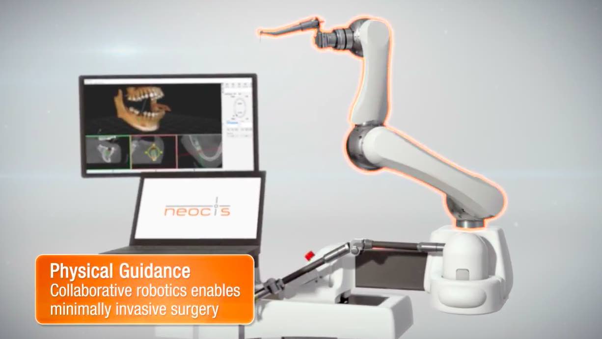 美國(guó)Neocis開(kāi)發(fā)Yomi機(jī)器人系統(tǒng) 讓牙醫(yī)植牙變得更簡(jiǎn)單-肽度TIMEDOO