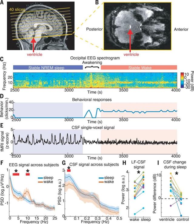 熬夜為何會(huì)變傻？科學(xué)家發(fā)現(xiàn)睡眠中的“洗腦”過(guò)程，可清除毒素-肽度TIMEDOO