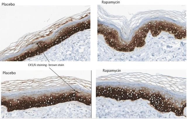 比肩二甲雙胍，這款“神藥”再添抗衰老新證： 涂抹4個月皮膚就改觀-肽度TIMEDOO