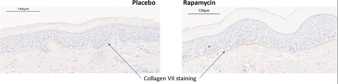 比肩二甲雙胍，這款“神藥”再添抗衰老新證： 涂抹4個月皮膚就改觀-肽度TIMEDOO