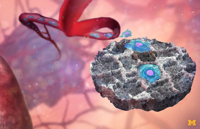 美國密歇根大學：研發(fā)出癌細胞微型捕捉器可用于癌癥診斷、治療與監(jiān)測-肽度TIMEDOO