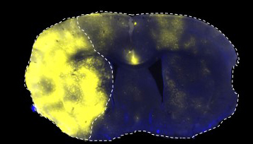 英國(guó)曼徹斯特大學(xué):利用納米粒子跨越血腦屏障治療中風(fēng)-肽度TIMEDOO