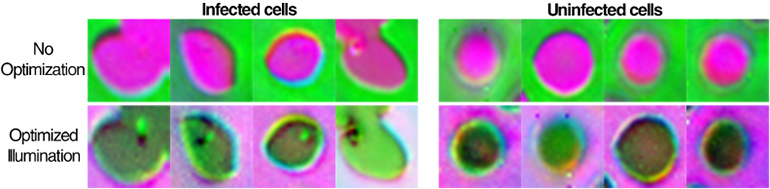 杜克大學(xué):開(kāi)發(fā)智能顯微鏡學(xué)習(xí)診斷傳染病，準(zhǔn)確率達(dá)90%-肽度TIMEDOO