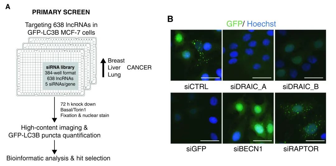 案例解讀丨高通量高內(nèi)涵siRNA文庫篩選發(fā)現(xiàn)lncRNA DRAIC為新型自噬調(diào)節(jié)因子-肽度TIMEDOO