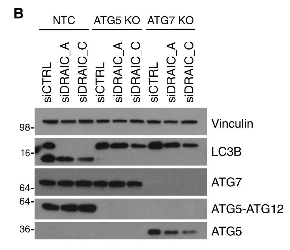 案例解讀丨高通量高內(nèi)涵siRNA文庫篩選發(fā)現(xiàn)lncRNA DRAIC為新型自噬調(diào)節(jié)因子-肽度TIMEDOO
