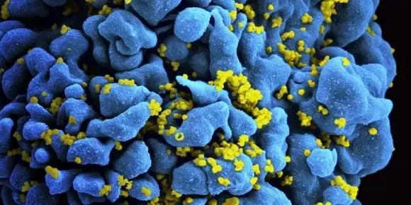 葛蘭素史克宣稱一長效藥可預防艾滋??！超4500人大型研究揭示：兩月注射一次，收效接近疫苗-肽度TIMEDOO