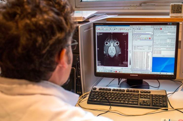 美國(guó)賓州大學(xué)與英特爾合作 用聯(lián)邦學(xué)習(xí)Federated Learning檢測(cè)腦瘤-肽度TIMEDOO