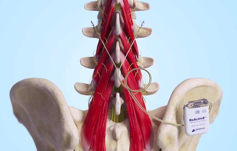 愛爾蘭公司 Reactitiv8 獲FDA批準(zhǔn)治療神經(jīng)性背痛-肽度TIMEDOO