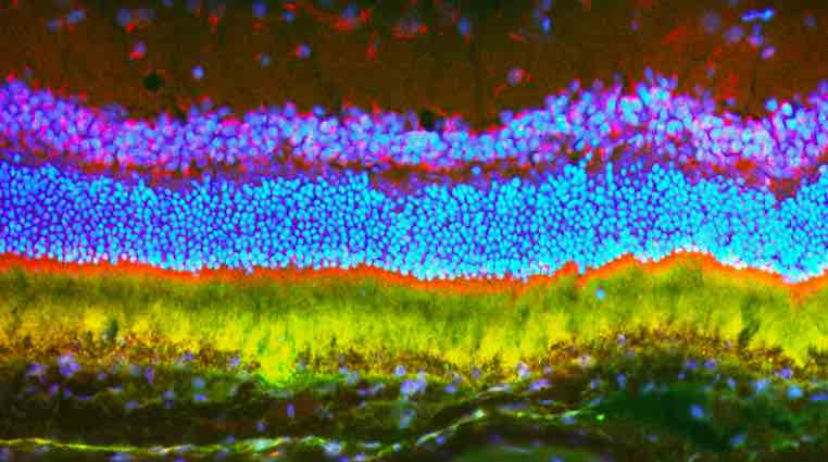 約翰·霍普金斯大學:開發(fā)出用于大基因治療眼科常見病的納米粒子-肽度TIMEDOO