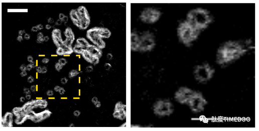 重大進展！5000例臨床全基因組測序揭示腫瘤環(huán)狀DNA全貌！再邀吳思涵獨家解讀自然新發(fā)現(xiàn)-肽度TIMEDOO