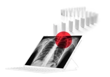 醫(yī)學(xué)影像公司Nanox：利用MEMS技術(shù)開發(fā)X射線源，大幅降低醫(yī)學(xué)影像系統(tǒng)的成本和體積-肽度TIMEDOO