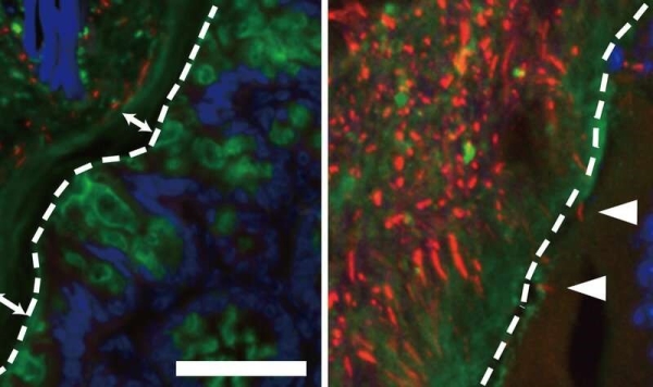 北海道大學(xué):干細(xì)胞移植后,腸道杯狀細(xì)胞的減少會導(dǎo)致絕癥-肽度TIMEDOO