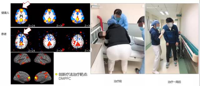 MIT和哈佛頂尖中國腦科學(xué)家回國創(chuàng)業(yè)，創(chuàng)建腦疾病平臺！已部署多家三甲醫(yī)院-肽度TIMEDOO