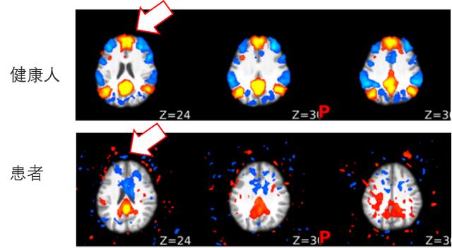 MIT和哈佛頂尖中國腦科學(xué)家回國創(chuàng)業(yè)，創(chuàng)建腦疾病平臺！已部署多家三甲醫(yī)院-肽度TIMEDOO