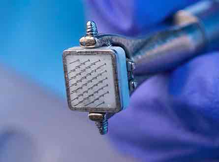 墨爾本莫納什大學(xué):開發(fā)出無線腦植入技術(shù)讓盲人重見光明-肽度TIMEDOO