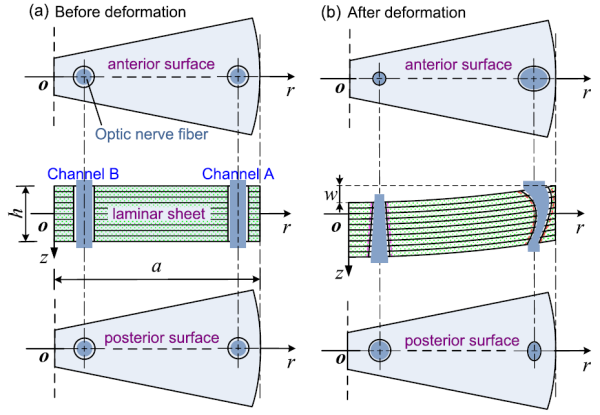 力學研究所: 在青光眼致病機理研究中獲進展-肽度TIMEDOO
