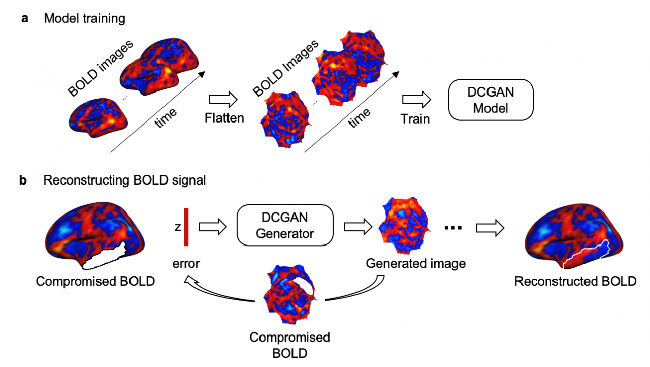 1602120083539056966.png 清華大學(xué)醫(yī)學(xué)院聯(lián)合多家院校: 采用深度學(xué)習(xí)方法解決功能磁共振缺損信號(hào)修復(fù)難題-肽度TIMEDOO