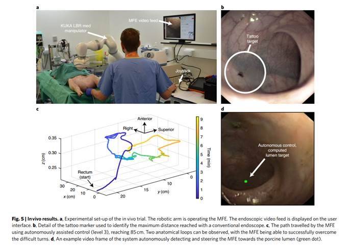 英科學家發(fā)明結腸鏡檢查機器人，可在實時視覺分析下自主運動-肽度TIMEDOO