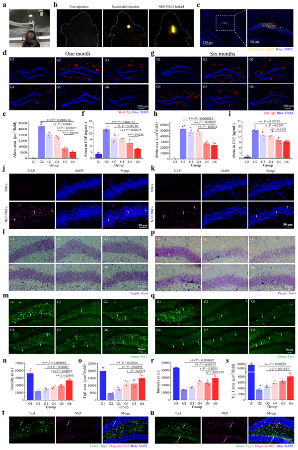 蘇州納米所開(kāi)發(fā)出納米藥劑介導(dǎo)的阿爾茨海默病干細(xì)胞療法-肽度TIMEDOO