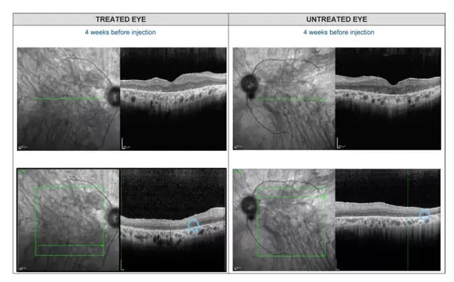 科學(xué)家將藻類基因注入人類眼睛，失明40年老人重獲部分視力！首例基因療法重塑視覺神經(jīng)-肽度TIMEDOO
