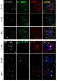 阿爾茲海默癥與長(zhǎng)壽由同一關(guān)鍵因素影響 抑制它，或可延長(zhǎng)壽命、預(yù)防阿爾茲海默癥！-肽度TIMEDOO