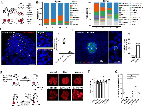6378491598875324136636264.jpg 治癌新方向:殺死胞內(nèi)菌 抑制癌轉(zhuǎn)移 科學(xué)家首次證實(shí)腫瘤菌群的重要生理功能-肽度TIMEDOO