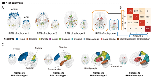 AD功能亞型特點.png 腦網(wǎng)絡(luò)研究為阿爾茨海默病精準診療奠定基礎(chǔ)-肽度TIMEDOO