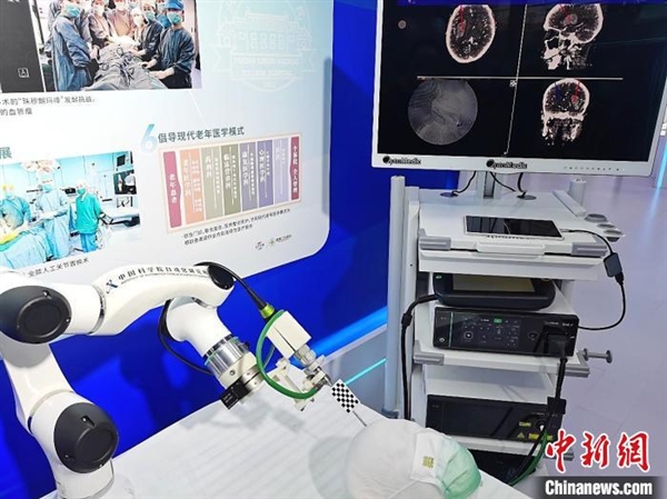 我國團(tuán)隊(duì)合作研發(fā)出視觸融合智能微創(chuàng)神經(jīng)內(nèi)鏡機(jī)器人-肽度TIMEDOO