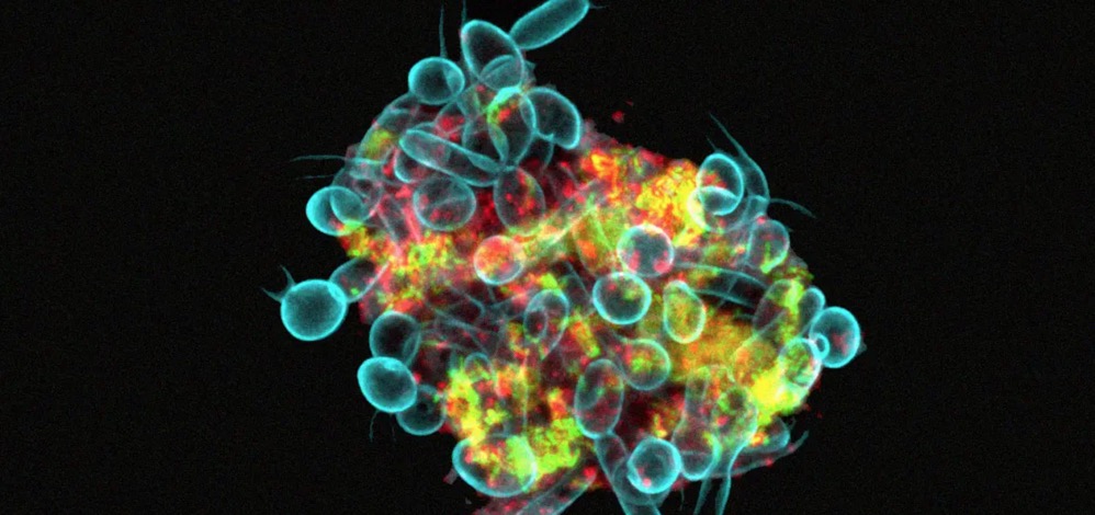 研究人員稱微生物會(huì)聚集成“超級(jí)生物體”會(huì)嚴(yán)重破壞牙齒-肽度TIMEDOO