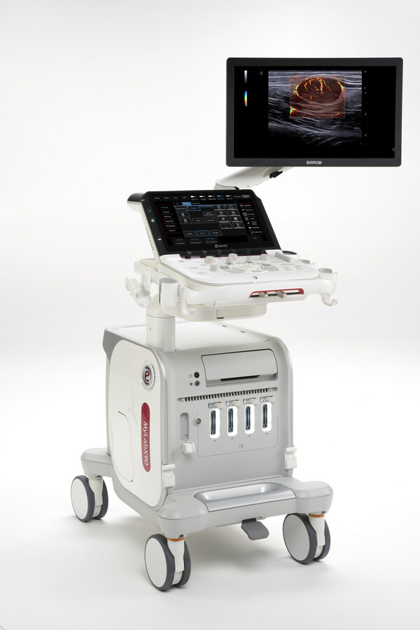 MyLab?X90,Esaote new premium ultrasound system. Esaote的新MyLab(TM) X90超聲裝置-肽度TIMEDOO