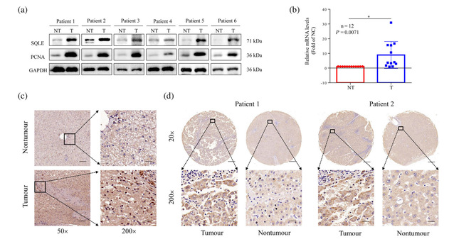 南京大學生科院殷武教授課題組揭示膽固醇限速酶作為肝癌治療新靶標的作用機制-肽度TIMEDOO