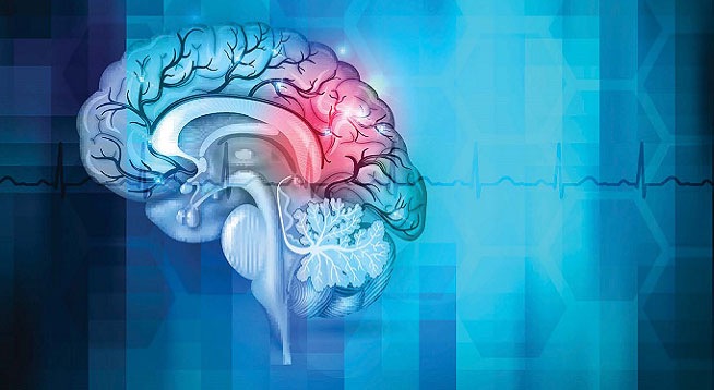 研究發(fā)現(xiàn):兩種蛋白質(zhì)可促進(jìn)中風(fēng)后的神經(jīng)恢復(fù)-肽度TIMEDOO