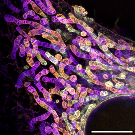 image2.jpg 未來技術學院陳知行課題組與合作者研發(fā)新探針實現(xiàn)對固定細胞線粒體的STED成像-肽度TIMEDOO