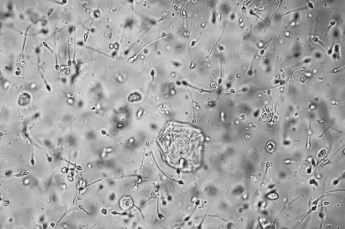 新避孕藥有望實現(xiàn)可逆性不育-肽度TIMEDOO