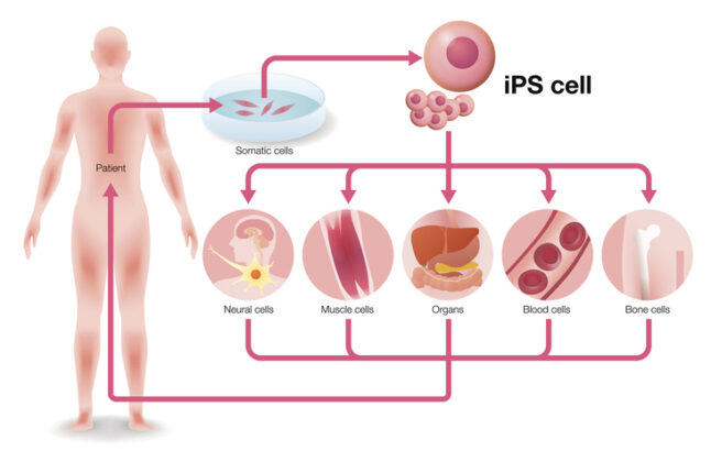 iPSCs：先進治療的“起始物料”，為大規(guī)模疾病治療帶來希望-肽度TIMEDOO