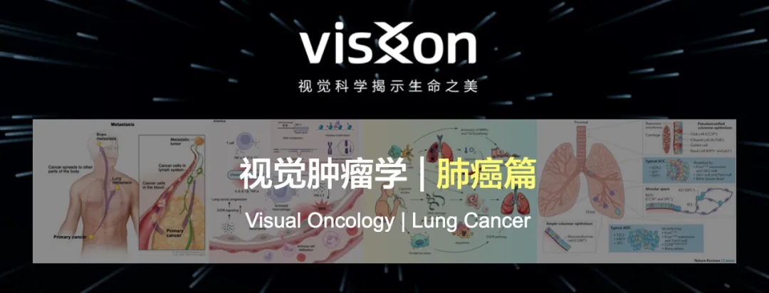 一圖讀懂|從藝術(shù)角度盤點10張“肺癌”高水平機制圖-肽度TIMEDOO