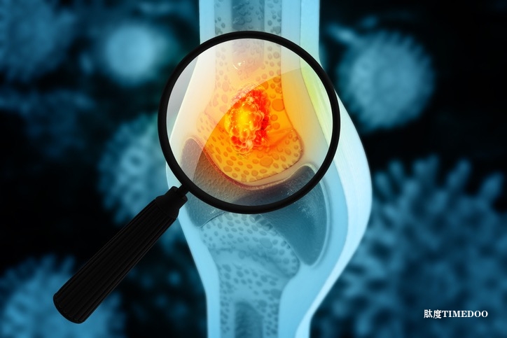 改良CAR T細(xì)胞：提高歸巢能力，開啟骨肉瘤治療新篇章-肽度TIMEDOO