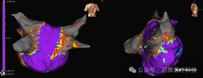 邁微醫(yī)療完成近億元A輪融資-肽度TIMEDOO