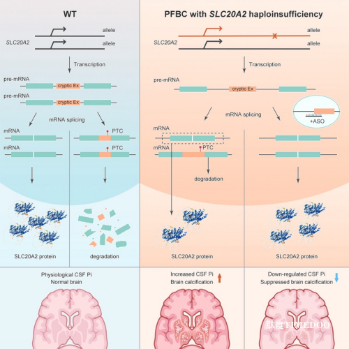 科學(xué)家開發(fā)出腦鈣化癥反義核苷酸療法-肽度TIMEDOO