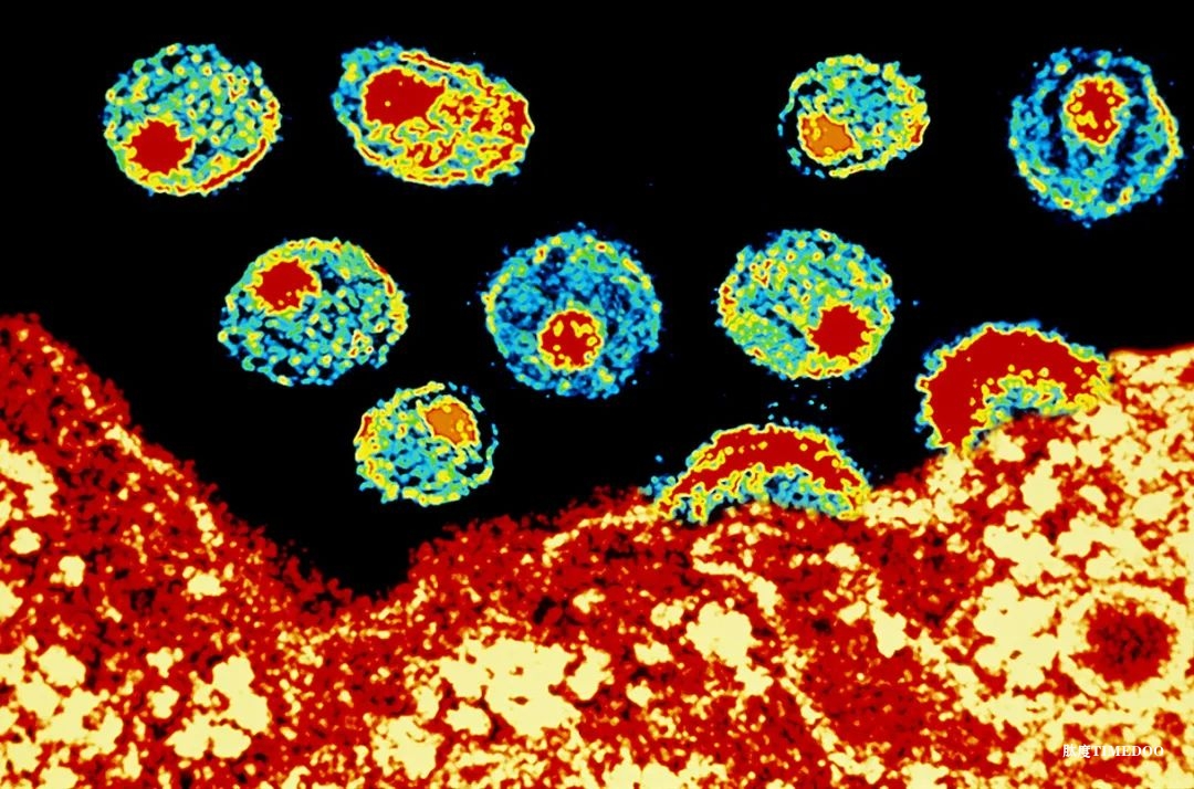 以毒攻毒遏制艾滋病！“去勢”HIV通過首次測試-肽度TIMEDOO