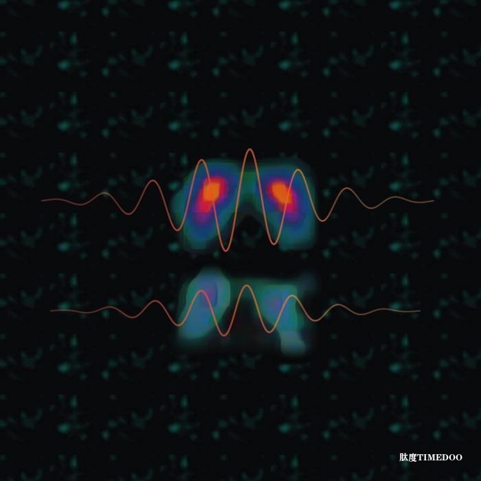 帕金森病震顫與多巴胺關(guān)系的新發(fā)現(xiàn)-肽度TIMEDOO