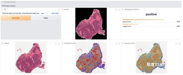 LG AI Research使用亞馬遜云科技開發(fā)AI模型 加快癌癥診斷速度-肽度TIMEDOO