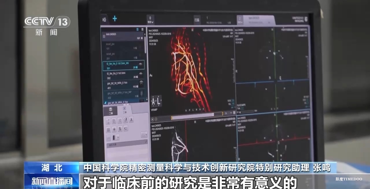 中國科學(xué)院團(tuán)隊成功突破“多核”磁共振成像技術(shù)-肽度TIMEDOO