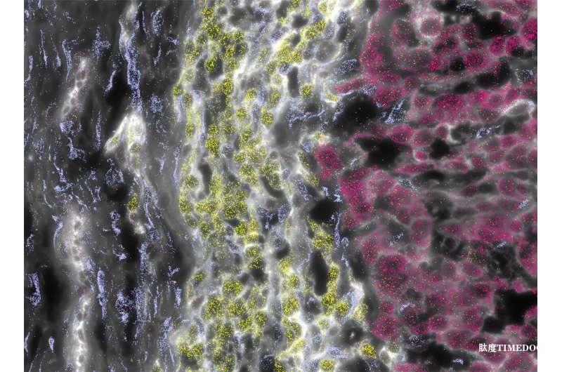 新發(fā)現(xiàn)助力治療罕見肝癌:精準(zhǔn)診斷與臨床試驗為患者帶來希望-肽度TIMEDOO